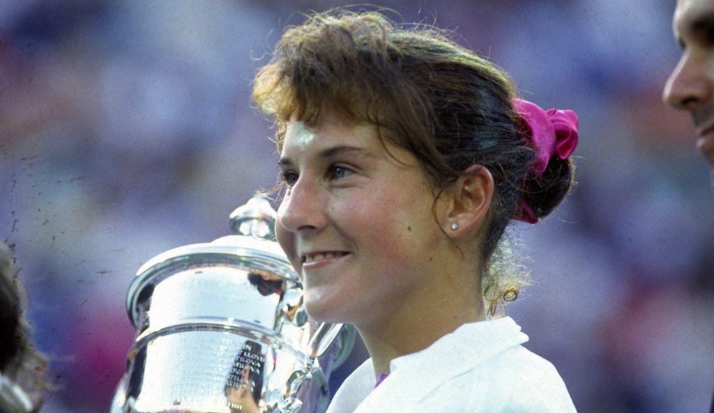 Monica Seles'S Comeback: From Autoimmune Disease To A Brighter Future - oy8hst9